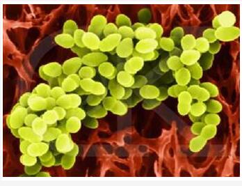 微生物降解技術(shù)